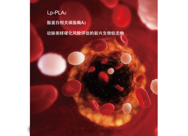Lp-PLA2----动脉粥样硬化斑块稳定性的评估标志物